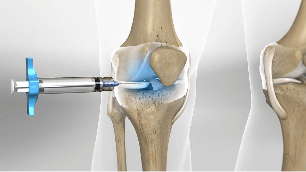 cortisone-injection-in-the-knee-is-it-safe-youtube